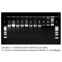 xme-xtreme-dna-isolation-kit-results